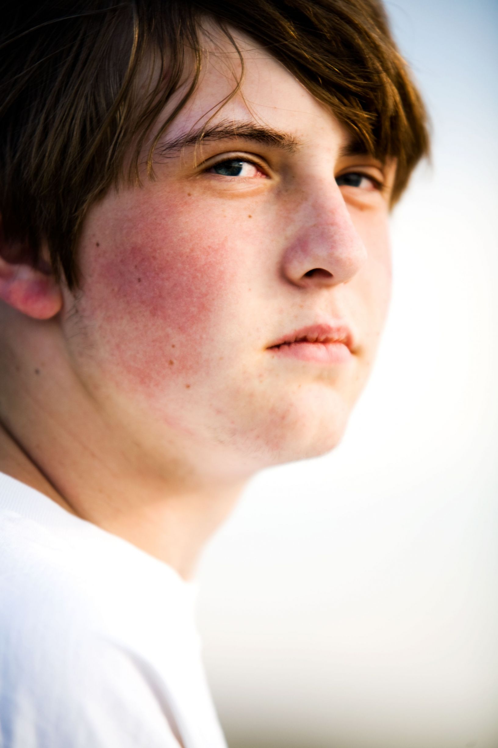 What is Bipolar disorder?
