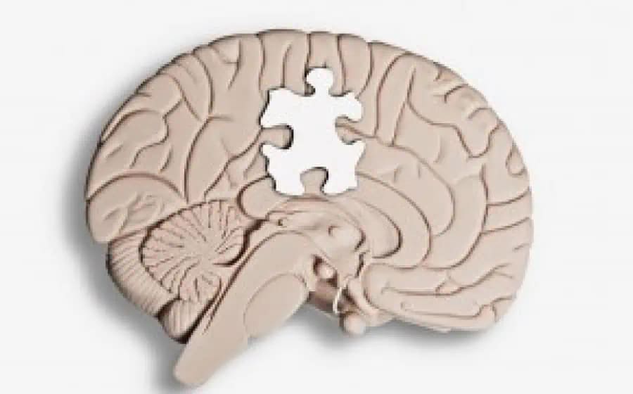 Autism Diagnostic Evaluation